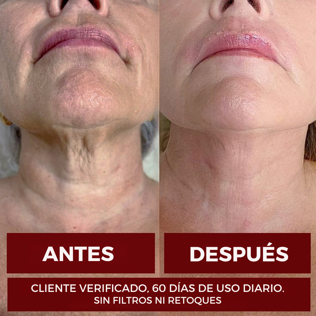 ZOOONE NAD+ Líquido